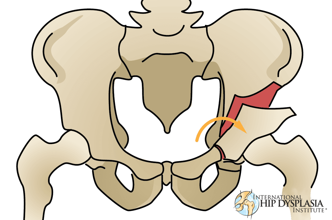 PO Biebelebons foto 4