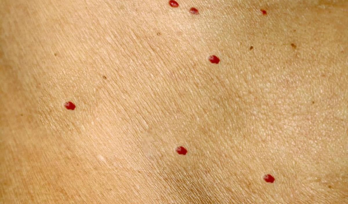 PO 't Vliegje foto 10